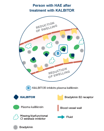 Person with HAE after treatment with KALBITOR.